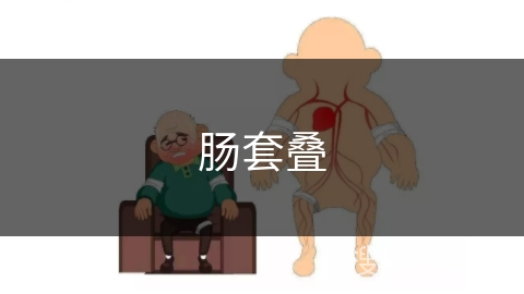 肠套叠